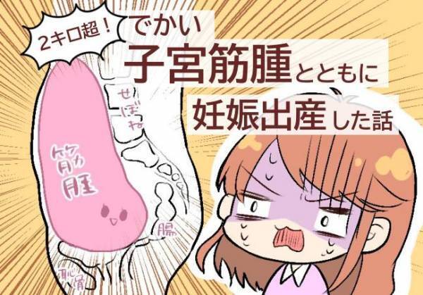 ＜子宮筋腫合併妊娠＞「筋腫があっても妊娠できた」喜んだのも束の間…トイレでまさかの事態に！