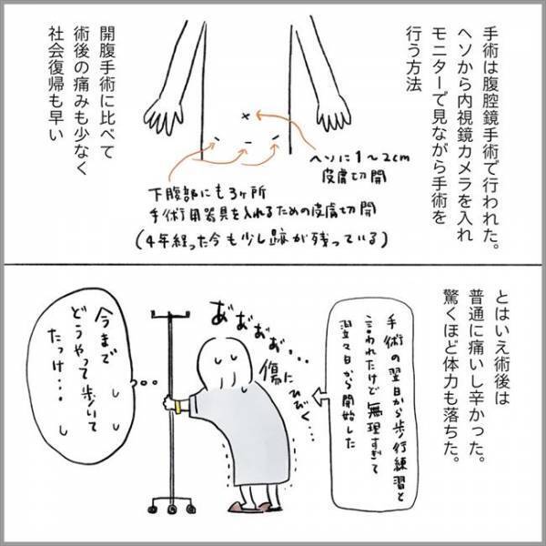 ＜卵巣のう腫破裂＞「手術をしたのに」そんな…。医師から告げられた言葉に思わず…