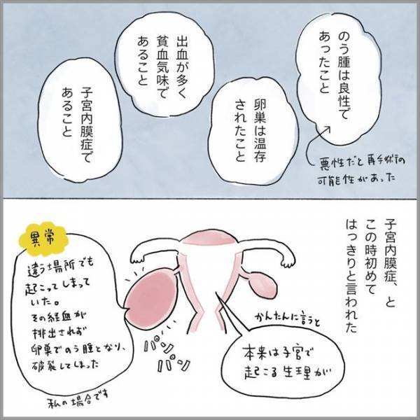 ＜卵巣のう腫破裂＞「手術をしたのに」そんな…。医師から告げられた言葉に思わず…