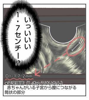 ＜病室トラブル＞「アカンこれ」妊婦健診で先生から慌てた表情で言われてしまって…