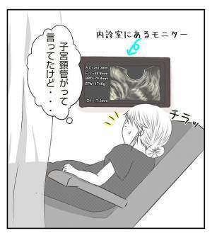 ＜病室トラブル＞「アカンこれ」妊婦健診で先生から慌てた表情で言われてしまって…