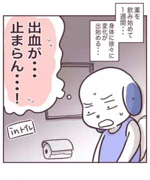 ＜チョコレート嚢胞体験談＞「生理がこない」原因はストレス？それともまさか…思い当たるのは