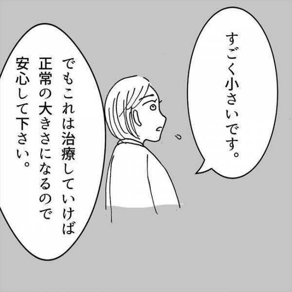 ＜JKなのに生理がない＞「子宮が小さいです」手術？治療？まさかの言葉に脳内はパニック…