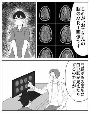 ＜危なかった出産＞「ただ、強いて言えば…」わが子の脳の検査結果が判明。医師からは…