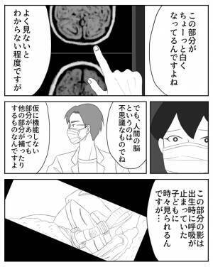 ＜危なかった出産＞「ただ、強いて言えば…」わが子の脳の検査結果が判明。医師からは…