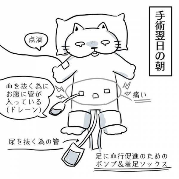 ＜卵巣のう腫体験談＞「人生で一番」壮絶な時間を乗り越えた後の「格別な体験」とは！？