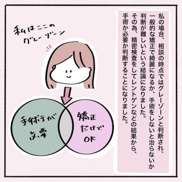 ＜歯列矯正＞えっ！私ってフツーの矯正じゃダメなの…？！