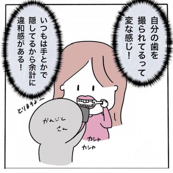 ＜歯列矯正＞「え！ダメなの？」顎にシワシワができる理由は…