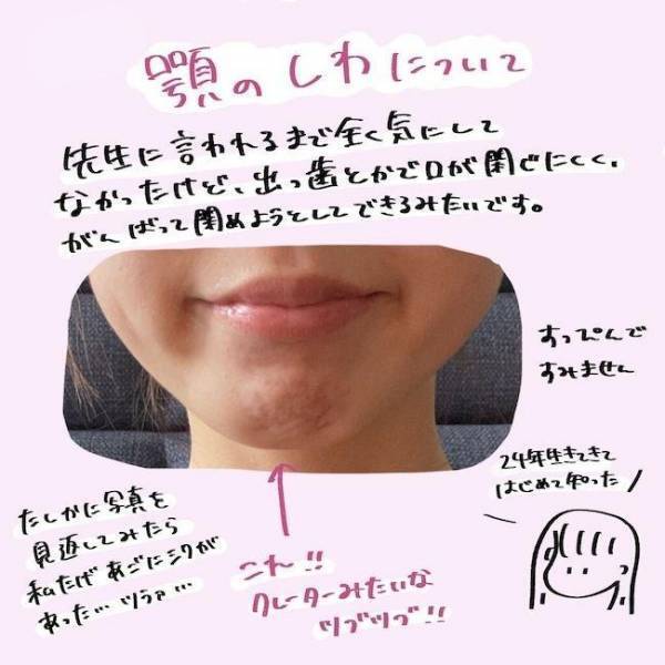 ＜歯列矯正＞「え！ダメなの？」顎にシワシワができる理由は…