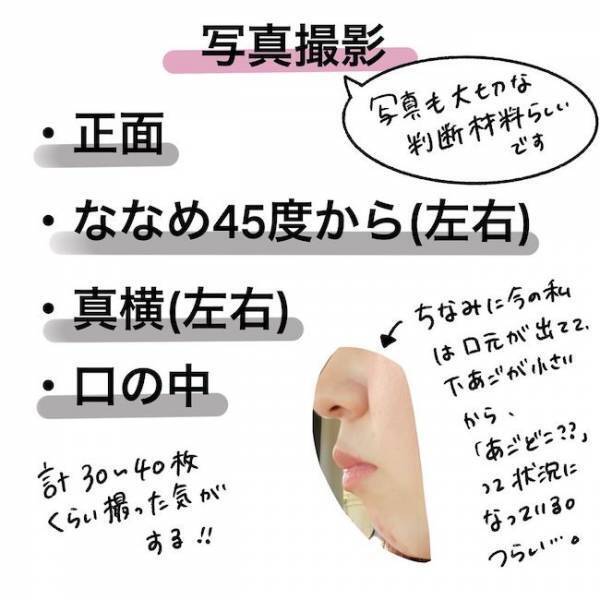 ＜歯列矯正＞「え！ダメなの？」顎にシワシワができる理由は…