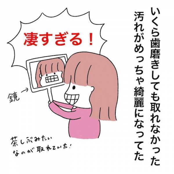 ＜歯列矯正＞「この感覚は…あれだ！」歯型チェックで口に入れたのは…