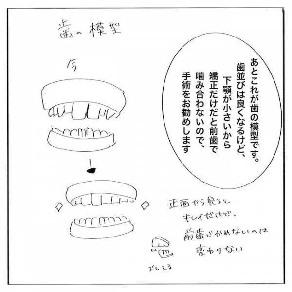 ＜歯列矯正＞「そ、そんなに抜くの…？！」外科手術が必要な理由は？