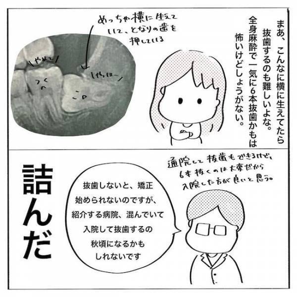 ＜歯列矯正＞「そ、そんなに抜くの…？！」外科手術が必要な理由は？