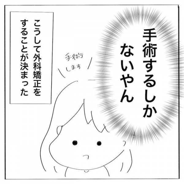 ＜歯列矯正＞「そ、そんなに抜くの…？！」外科手術が必要な理由は？