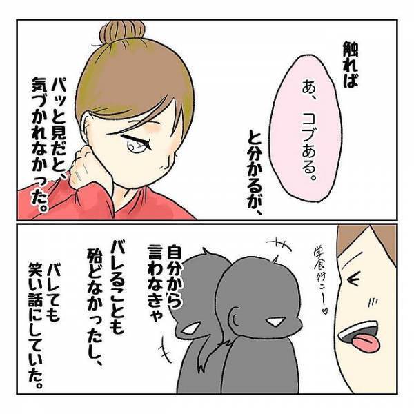 「こんなことになるなんて…」いつの間にか私の体にできていたのは！？