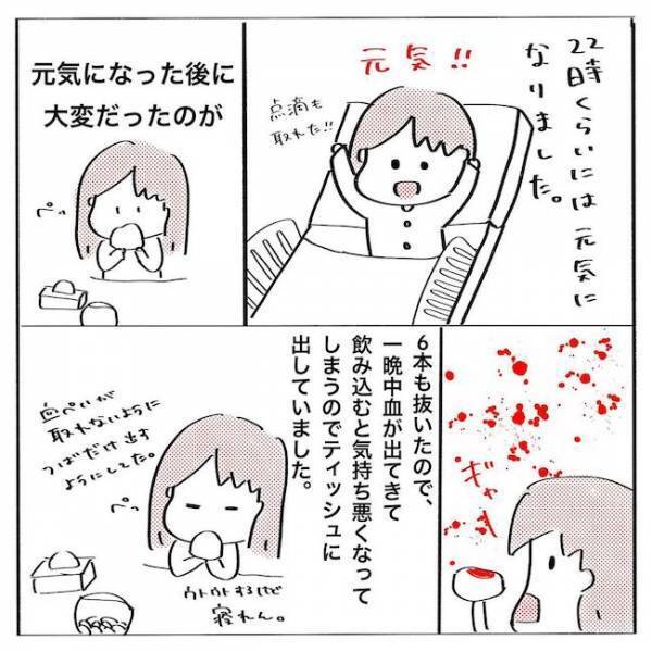 ＜歯列矯正＞「痛ぁっ！」全身麻酔に驚愕！ 抜歯後は口の中が大変なことに…