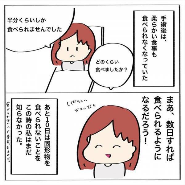＜歯列矯正＞「いただきまー…って、あれ？！」抜歯後の食事はまさかの…