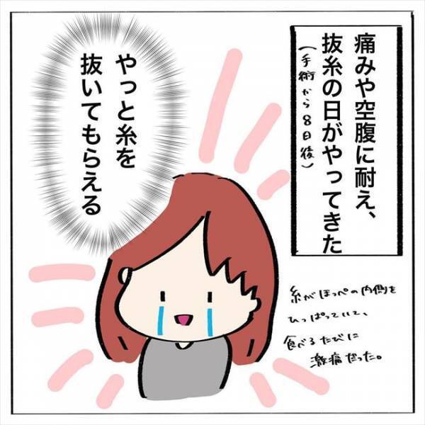 ＜歯列矯正＞「プリンも無理なんて…！」6本の抜歯で食べられるものがなく…