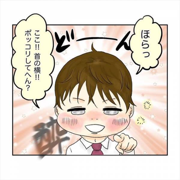 「ドキッ」何て答えるべき？首のコブを同僚男性に指摘されて…