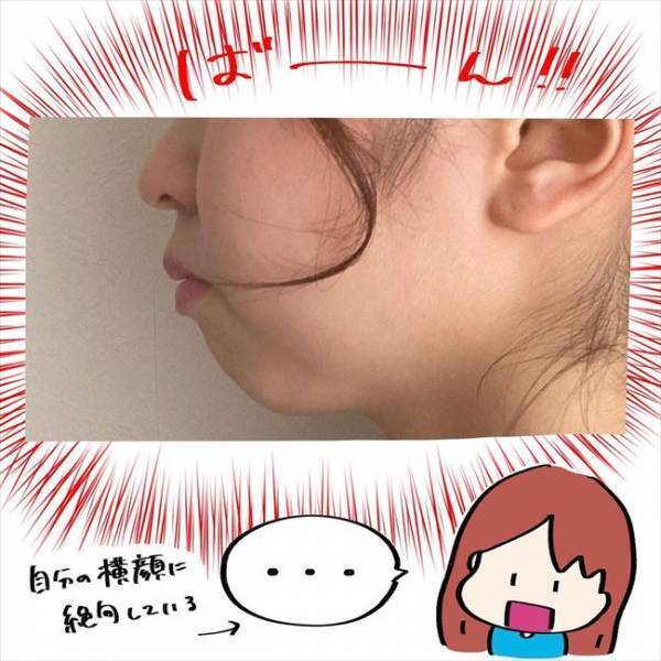 ＜歯列矯正＞「私って、フグゴリラ…？！」矯正装置をつけたら思わぬ悩みに直面！