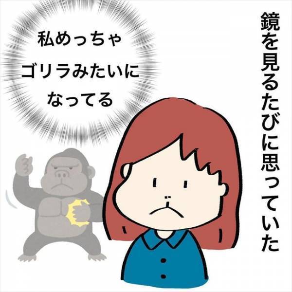 ＜歯列矯正＞「私って、フグゴリラ…？！」矯正装置をつけたら思わぬ悩みに直面！