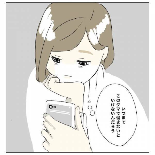 ＜内緒で美容整形＞「顔色悪いね…」元気なのに目の下が真っ黒。どうしたらいいの？