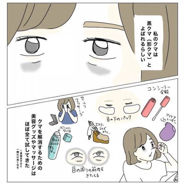 ＜内緒で美容整形＞「顔色悪いね…」元気なのに目の下が真っ黒。どうしたらいいの？