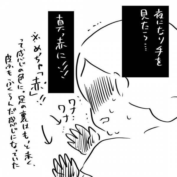 「なんだこれ！」手足が真っ赤に腫れて激痛！助けを求めて産婦人科に電話すると…？