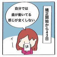 ＜歯列矯正＞「歯、動いてる…？」変化がない…。治療のモチベーションを上げるには？