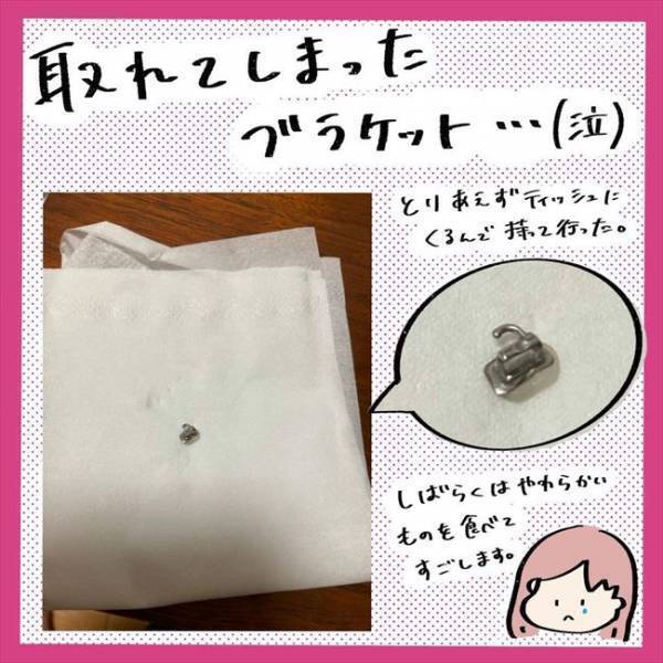 ＜歯列矯正＞「おはよー…って痛ぁっ！」寝起きに激痛！そして思わぬ事件も…