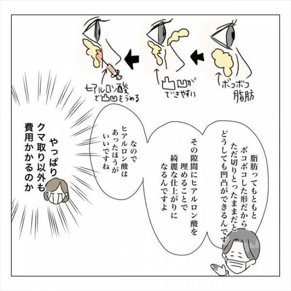 ＜内緒で美容整形＞「そんなに切るんですか…？！」気になるクマ取りの手術方法とは？