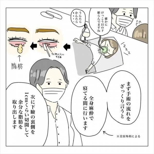 ＜内緒で美容整形＞「そんなに切るんですか…？！」気になるクマ取りの手術方法とは？