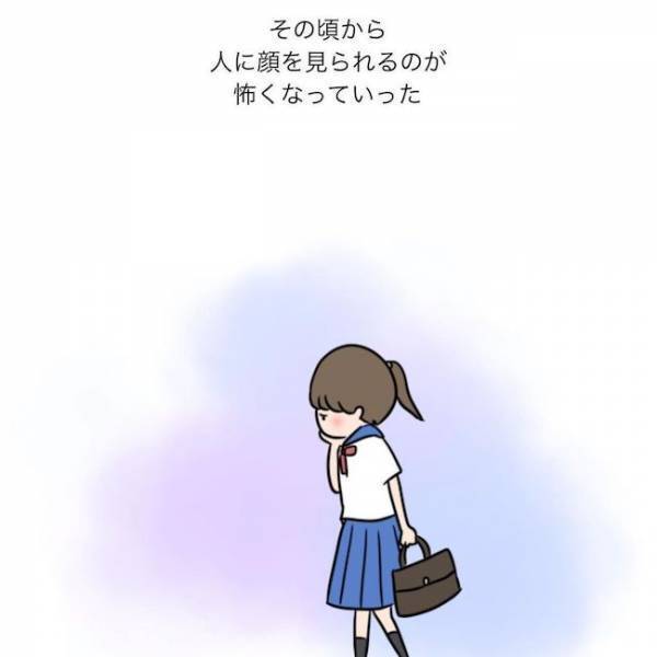 ＜ニキビ汚肌改善＞「顔洗いなよ…」顔を見られるのが怖い！ニキビと脂まみれの学生時代