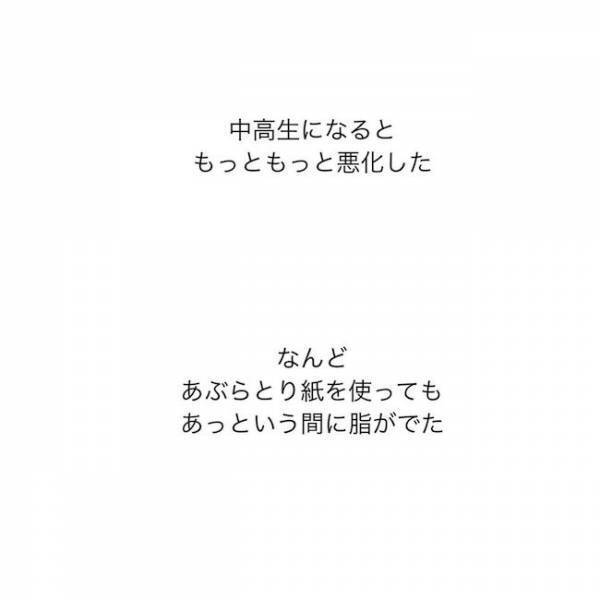 ＜ニキビ汚肌改善＞「顔洗いなよ…」顔を見られるのが怖い！ニキビと脂まみれの学生時代