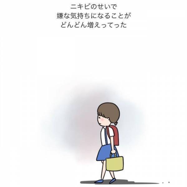 ＜ニキビ汚肌改善＞「顔洗いなよ…」顔を見られるのが怖い！ニキビと脂まみれの学生時代