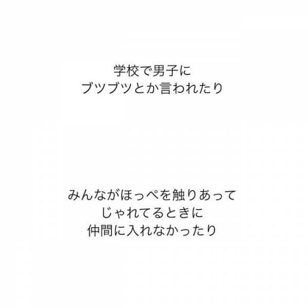 ＜ニキビ汚肌改善＞「顔洗いなよ…」顔を見られるのが怖い！ニキビと脂まみれの学生時代