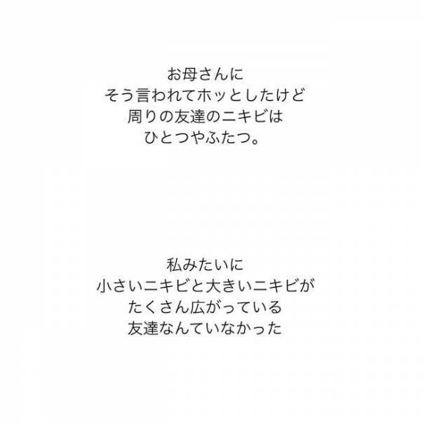 ＜ニキビ汚肌改善＞「顔洗いなよ…」顔を見られるのが怖い！ニキビと脂まみれの学生時代