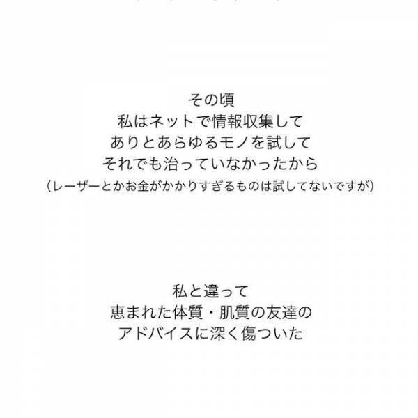 ＜ニキビ汚肌改善＞「顔洗いなよ…」顔を見られるのが怖い！ニキビと脂まみれの学生時代