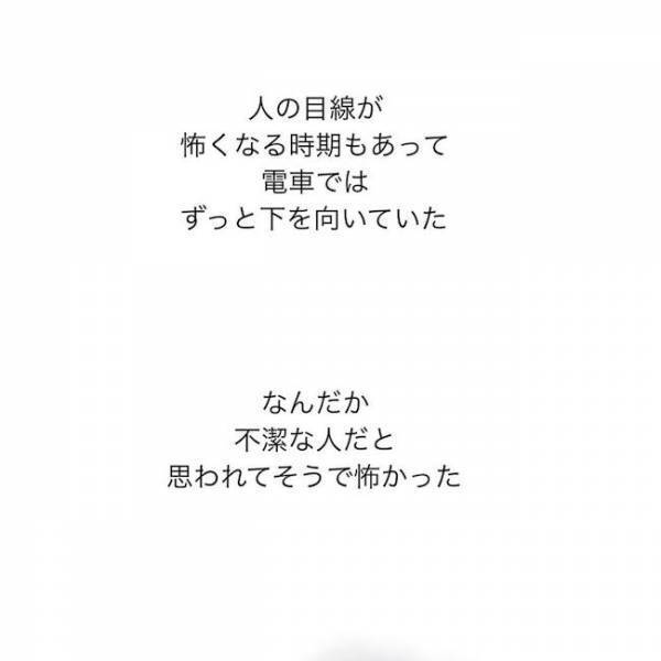 ＜ニキビ汚肌改善＞「不潔って思われる…」脂でいつも化粧崩れ。悩んだ私の最終手段は…
