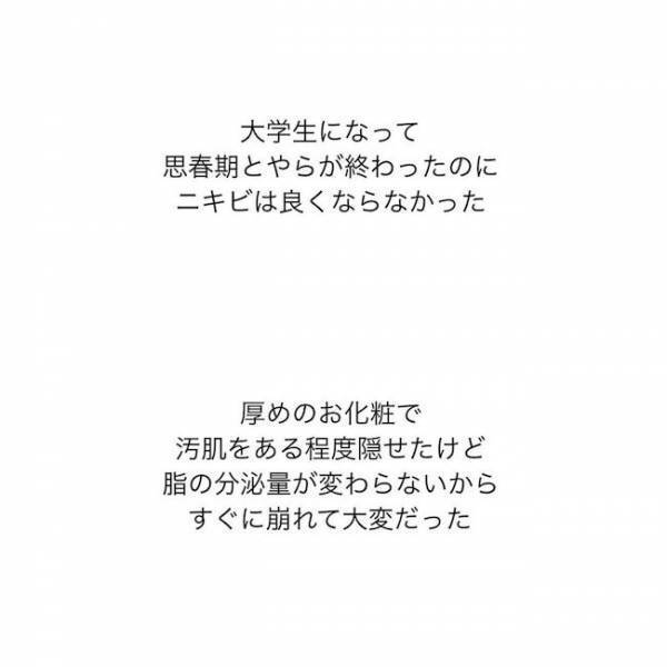 ＜ニキビ汚肌改善＞「不潔って思われる…」脂でいつも化粧崩れ。悩んだ私の最終手段は…