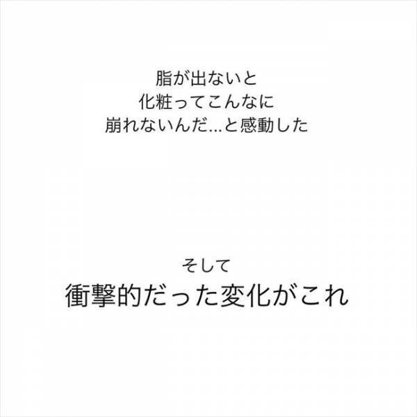 ＜ニキビ汚肌改善＞「うそ…胸が！」ホルモン治療でまさかの変化？！