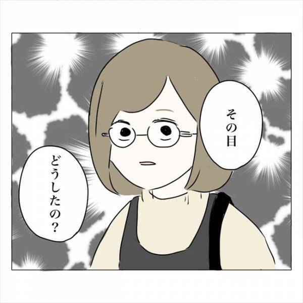 ＜内緒で美容整形＞「あら？あなた…」え！もしかして整形バレた！？実母の鋭い視線が…