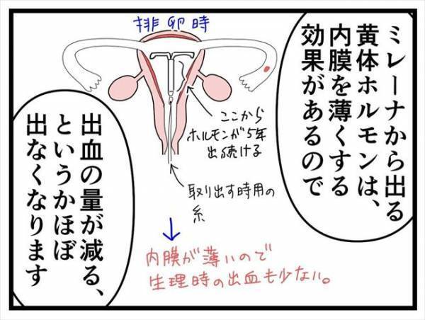 「入れてみないとわかりません」経産婦におすすめ？医師がめっちゃ推すワケは…
