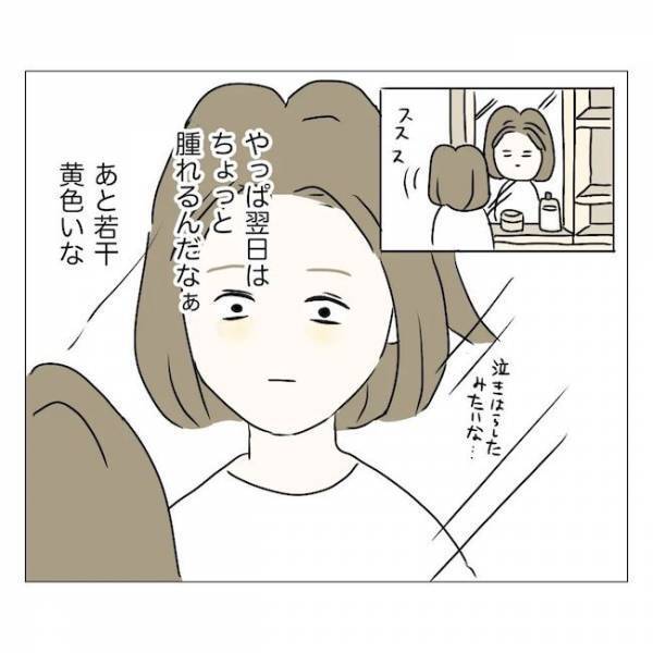 ＜内緒で美容整形＞「いつもと違うわよ…」母よ、気づかないで！手術翌日の目に変化…？！