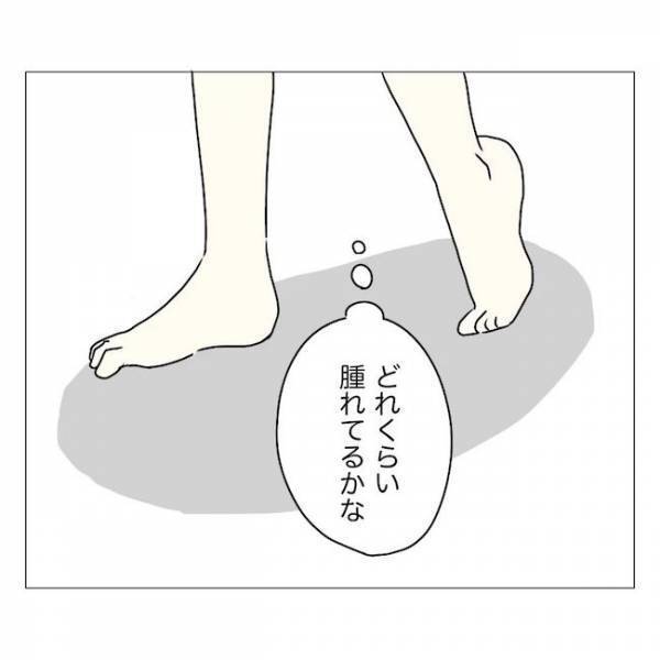 ＜内緒で美容整形＞「いつもと違うわよ…」母よ、気づかないで！手術翌日の目に変化…？！