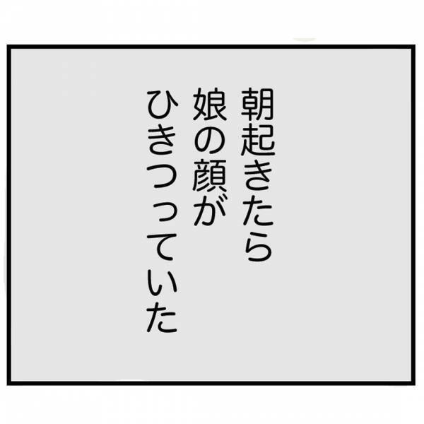 ＜娘が顔面麻痺になった話＞「もしかして…」朝目覚めると、娘の顔がひきつっていて…