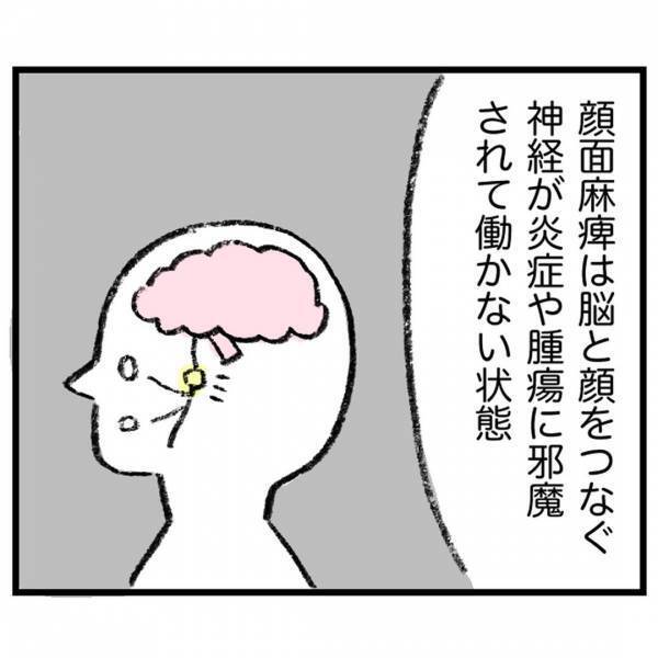 ＜娘が顔面麻痺になった話＞「えー無理だよ」顔面麻痺で入院が決まった娘。夫に電話したら