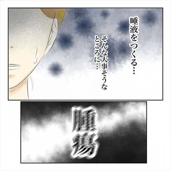 「腫瘍です。半分は悪性の」え…やばない？医師からコブの正体を聞かされて…