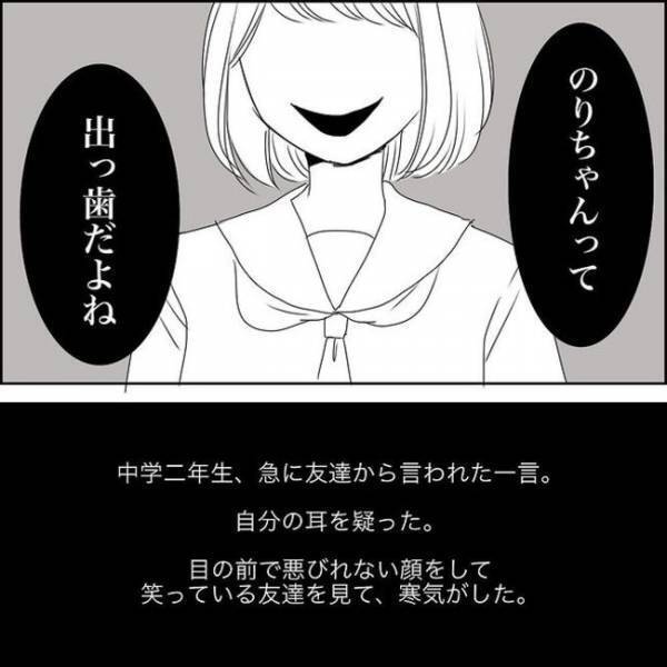 ＜歯列矯正で笑えるように＞「そんなに出てるんだ…」友人に笑いながら指摘されたことがショックで