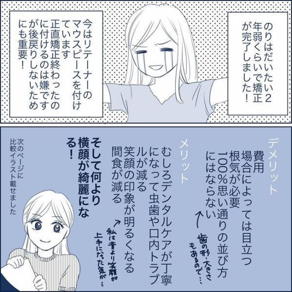 ＜歯列矯正をして笑えるように＞「鼻が高く…」矯正をした結果、見た目に驚きの変化が！？